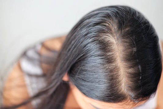 Understanding Stress-Induced Hair Loss: Causes, Symptoms, and Remedies