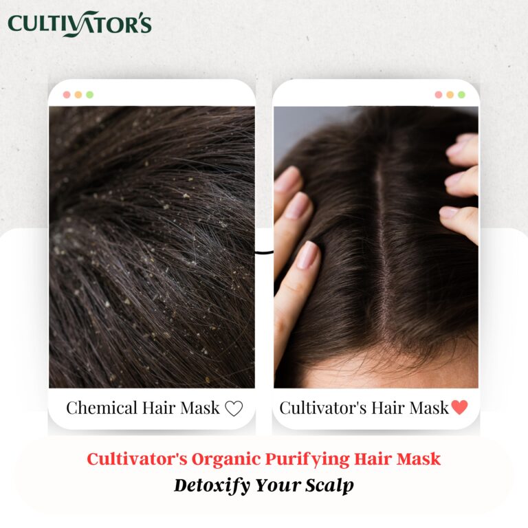 Cultivator_dandruff-free-hair